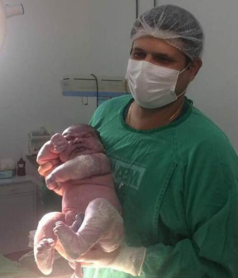 Bebê nasce com 6 kg e mais de meio metro: “Levei um susto quando vi ele’, diz mãe