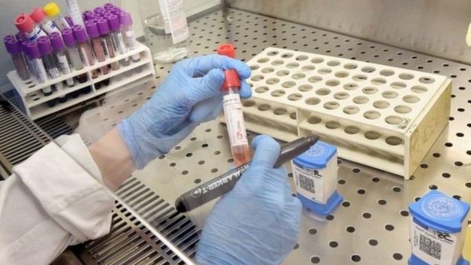 Cientistas: Relaxar isolamento em SC não tem respaldo científico e vai facilitar disseminação do coronavírus