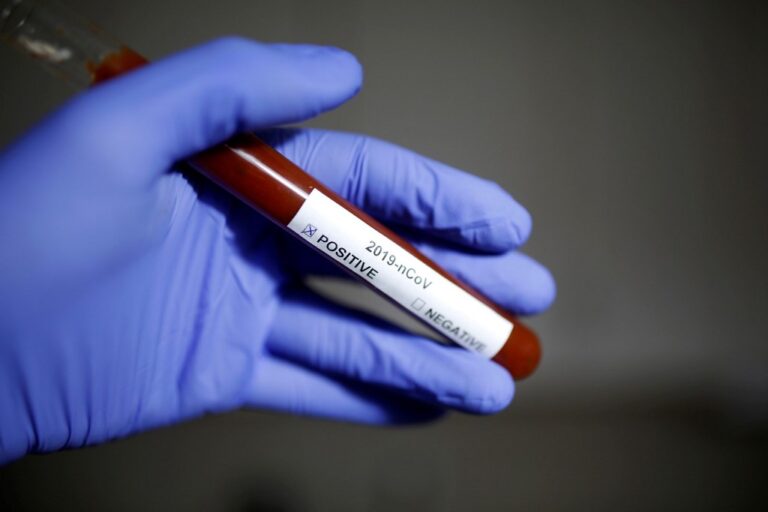 Secretaria de Saúde de Palmas (PR) confirma primeiro caso de Coronavírus