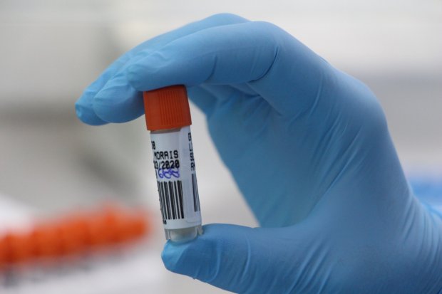 Covid-19: Lacen realiza mais de 405 mil testes RT-PCR em 2020