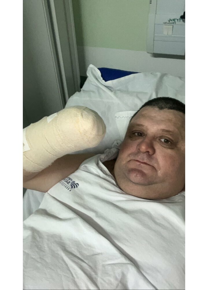 Humorista Pilha tem mão amputada após acidente com foguete