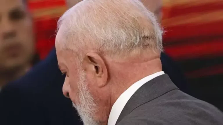 Lula é submetido a cirurgia de emergência no cérebro e está na UTI